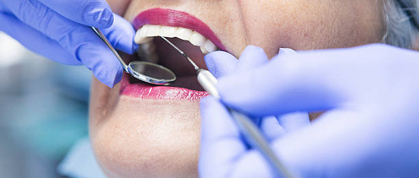 Best Emergency Broken Tooth Repair in Washington, PA